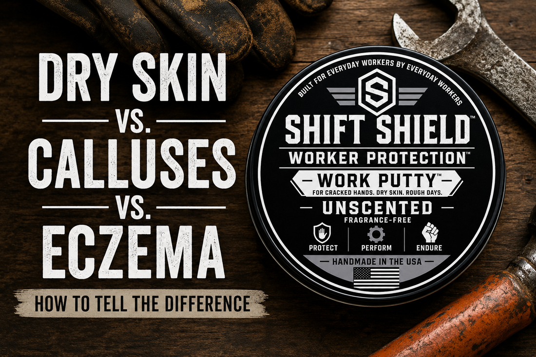 How to Tell the Difference Between Dry Skin, Calluses, and Eczema